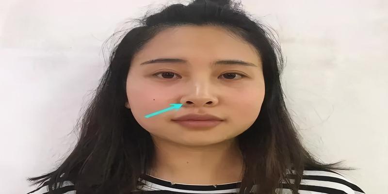 鼻孔漏财风水上怎么补救(鼻孔外露显土气)