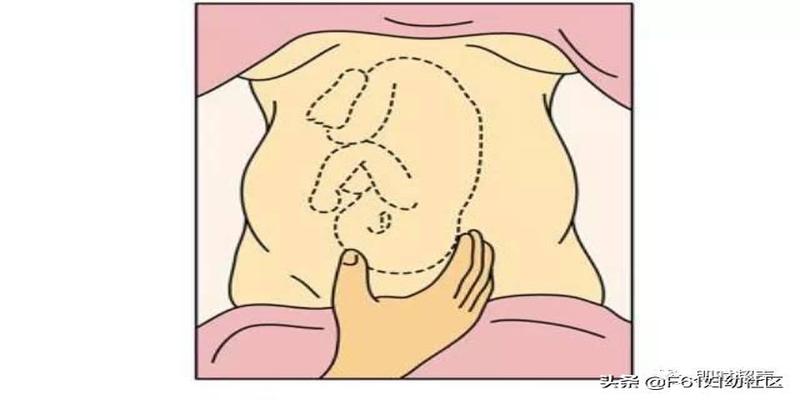 超声图像方位讲解图(如何通过超声辨别胎方位)