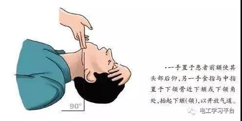 触电急救八字方针(当有人发生触电事故的应急措施)