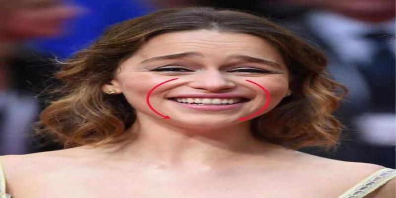 去除法令纹的精华排名(去除法令纹的护肤品)