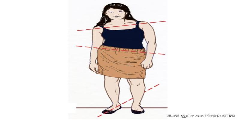 脚踝骨外翻(骨盆后倾大腿外翻)