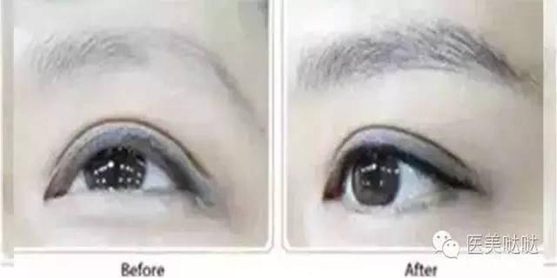 八字眉修眉毛教程(天生一副八字眉该如何逆袭成美妞)