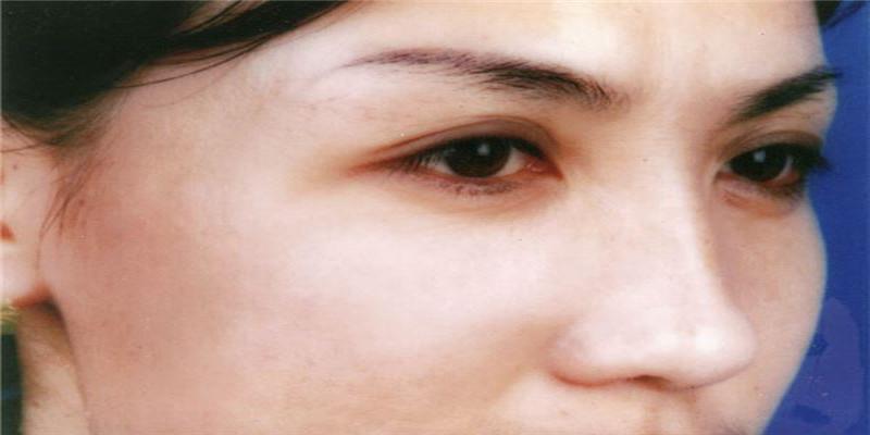 额头眉间有皱纹的面相怎么样？(眉间有毛 面相)