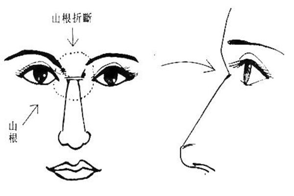面相，山根低的人运势是什么样呢？(山根低影响财运还是婚姻)