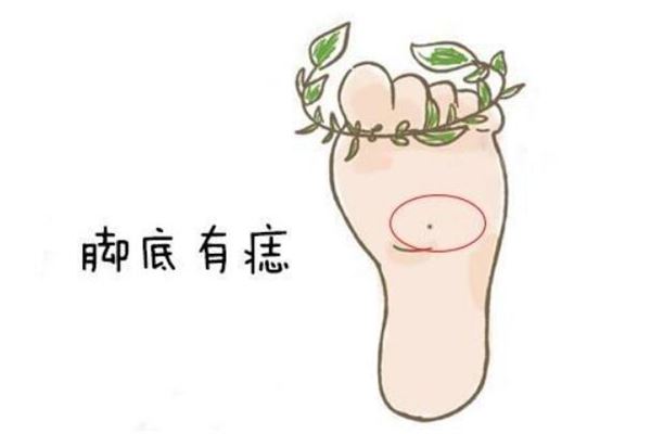 女人脚底有痣好不好(女人脚底有痣代表什么)