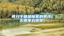 两只手都是断掌的男孩(左断掌右断掌)