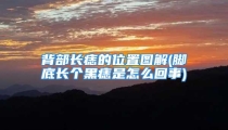 背部长痣的位置图解(脚底长个黑痣是怎么回事)